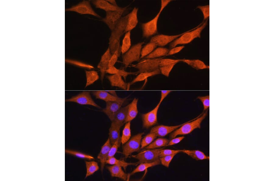 Immunofluorescence - Anti-AIRE Antibody (A13643) - Antibodies.com