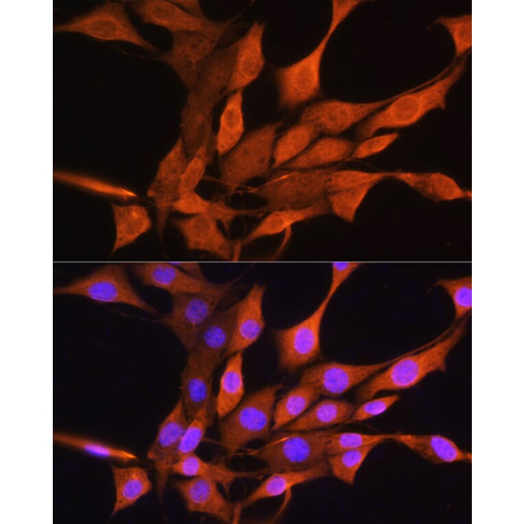 Immunofluorescence - Anti-AIRE Antibody (A13643) - Antibodies.com