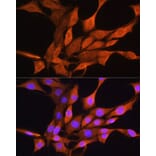 Immunofluorescence - Anti-AIRE Antibody (A13643) - Antibodies.com