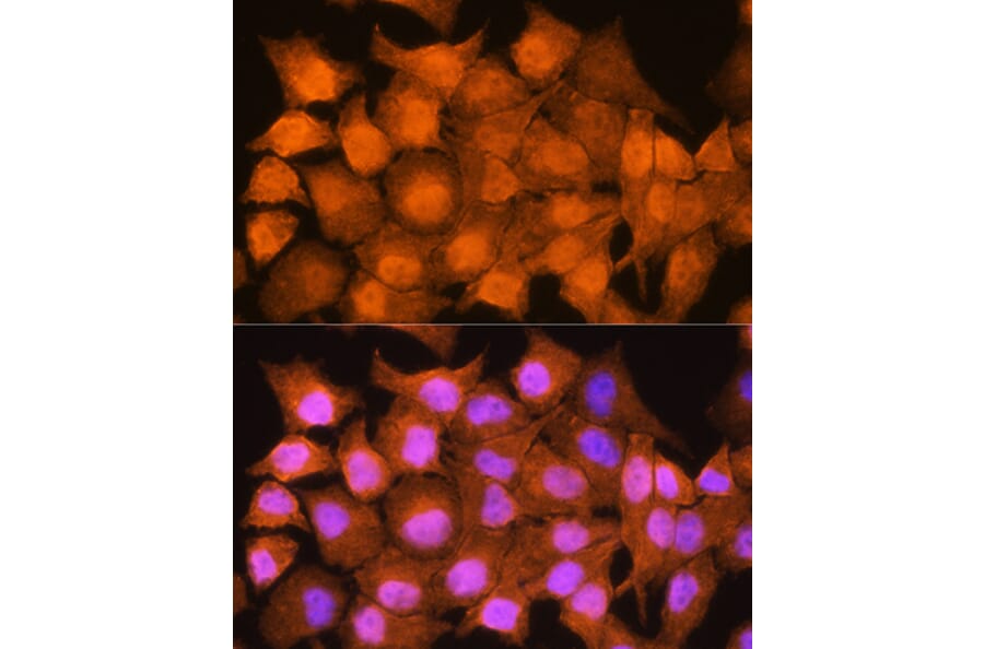 Immunofluorescence - Anti-AIRE Antibody (A13643) - Antibodies.com
