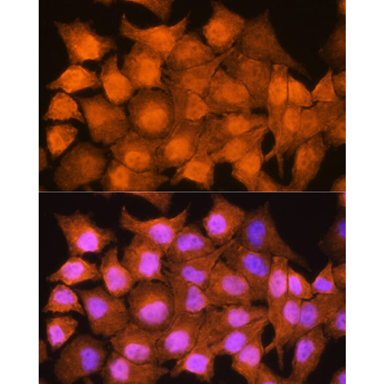 Immunofluorescence - Anti-AIRE Antibody (A13643) - Antibodies.com