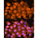 Immunofluorescence - Anti-AIRE Antibody (A13643) - Antibodies.com