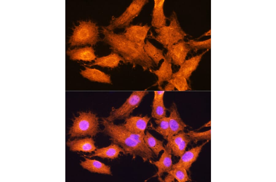 Immunofluorescence - Anti-AIRE Antibody (A13643) - Antibodies.com