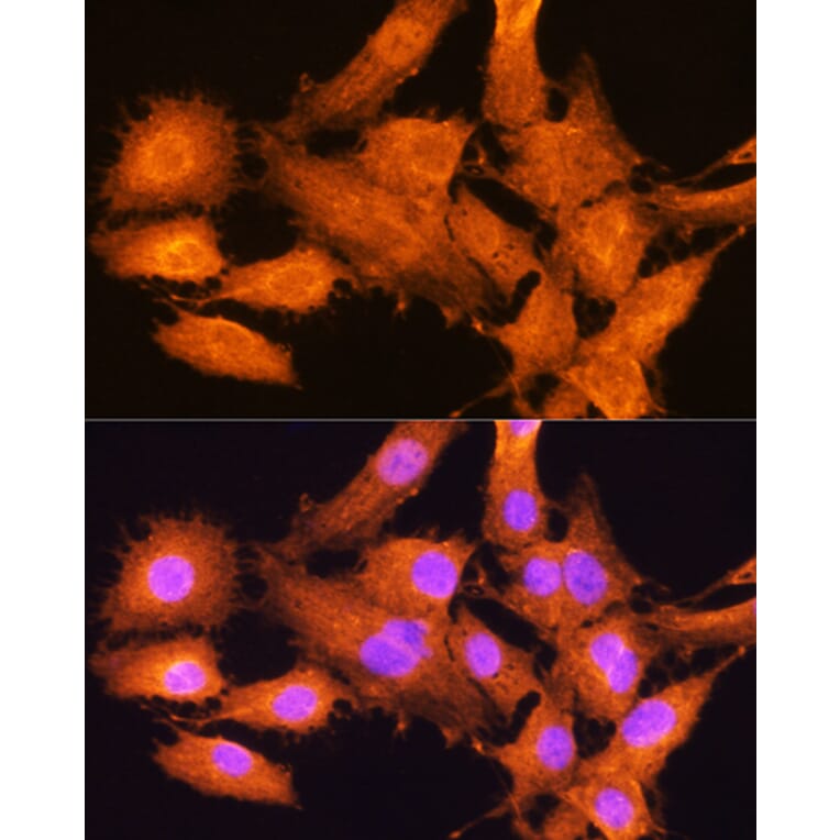 Immunofluorescence - Anti-AIRE Antibody (A13643) - Antibodies.com