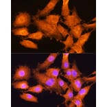 Immunofluorescence - Anti-AIRE Antibody (A13643) - Antibodies.com