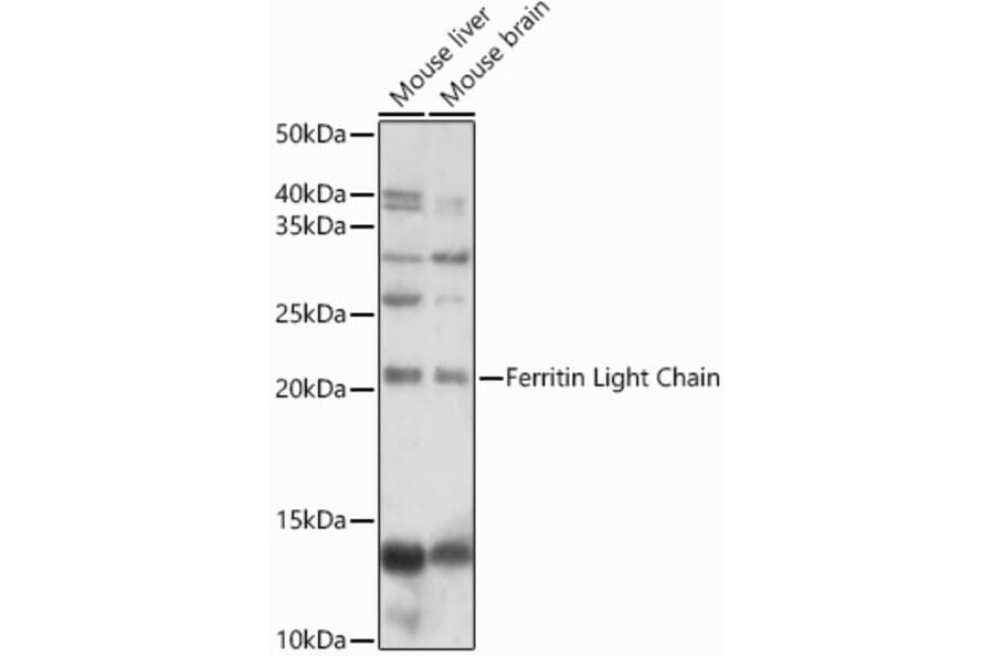 Western Blot - Anti-Ferritin Light Chain Antibody (A13644) - Antibodies.com