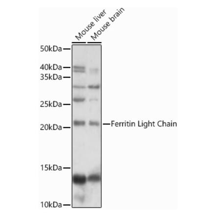 Western Blot - Anti-Ferritin Light Chain Antibody (A13644) - Antibodies.com