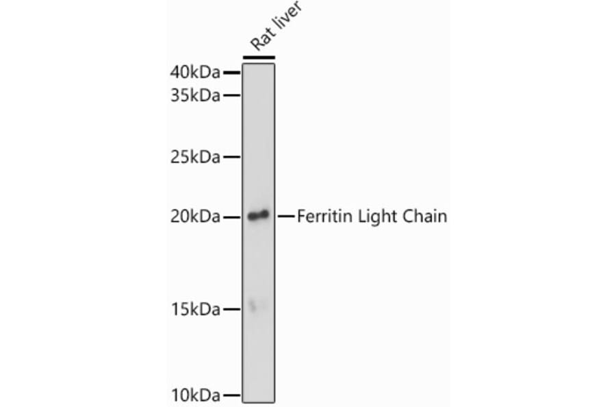 Western Blot - Anti-Ferritin Light Chain Antibody (A13644) - Antibodies.com