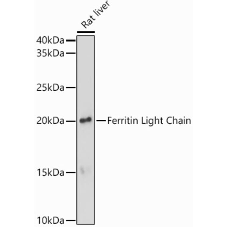 Western Blot - Anti-Ferritin Light Chain Antibody (A13644) - Antibodies.com