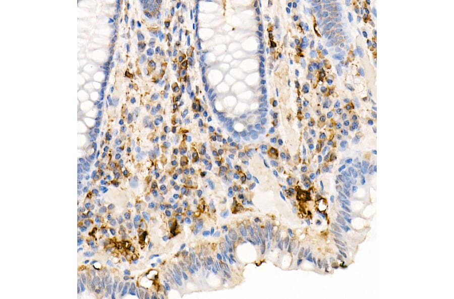 Immunohistochemistry - Anti-Ferritin Light Chain Antibody (A13644) - Antibodies.com
