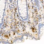 Immunohistochemistry - Anti-Ferritin Light Chain Antibody (A13644) - Antibodies.com