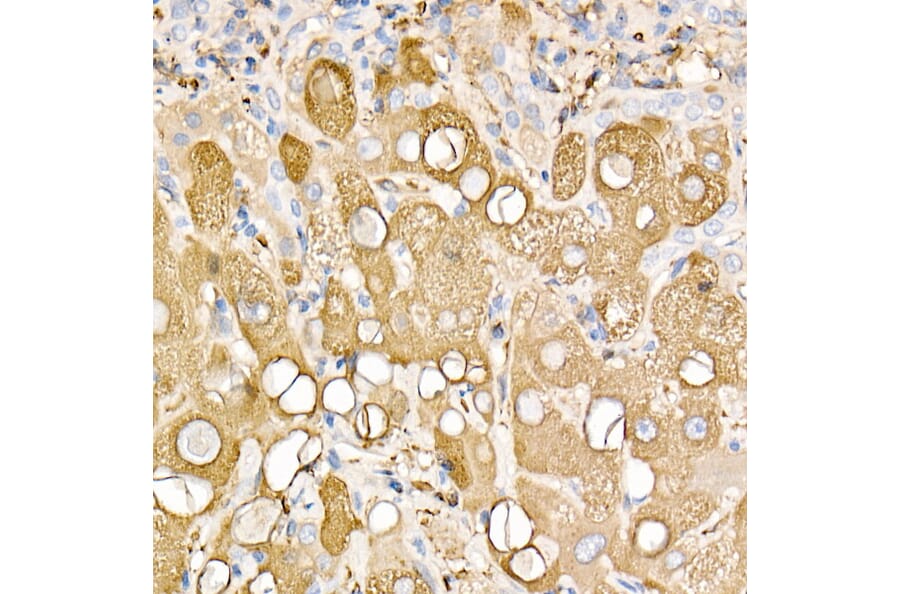 Immunohistochemistry - Anti-Ferritin Light Chain Antibody (A13644) - Antibodies.com