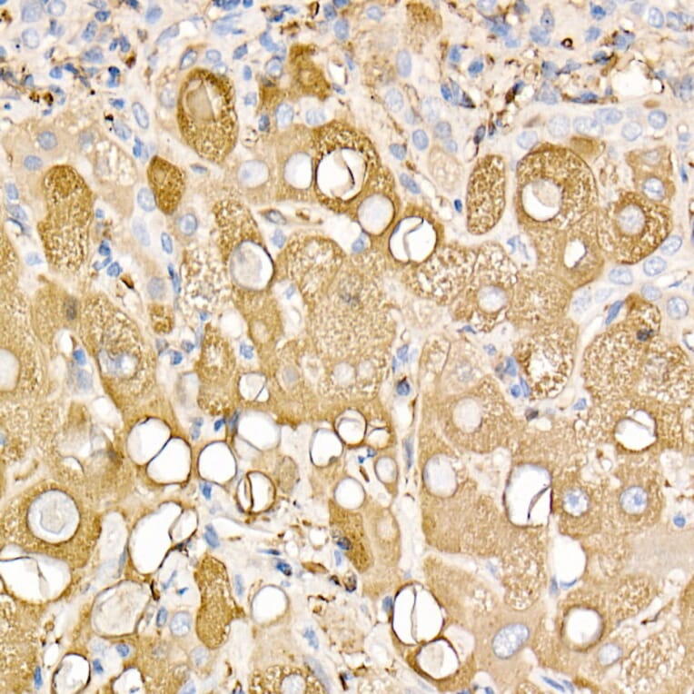 Immunohistochemistry - Anti-Ferritin Light Chain Antibody (A13644) - Antibodies.com