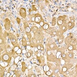 Immunohistochemistry - Anti-Ferritin Light Chain Antibody (A13644) - Antibodies.com