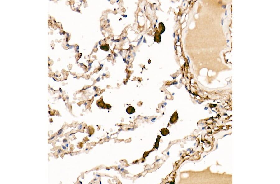 Immunohistochemistry - Anti-Ferritin Light Chain Antibody (A13644) - Antibodies.com