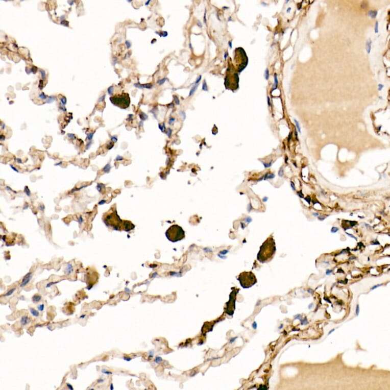 Immunohistochemistry - Anti-Ferritin Light Chain Antibody (A13644) - Antibodies.com