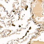 Immunohistochemistry - Anti-Ferritin Light Chain Antibody (A13644) - Antibodies.com