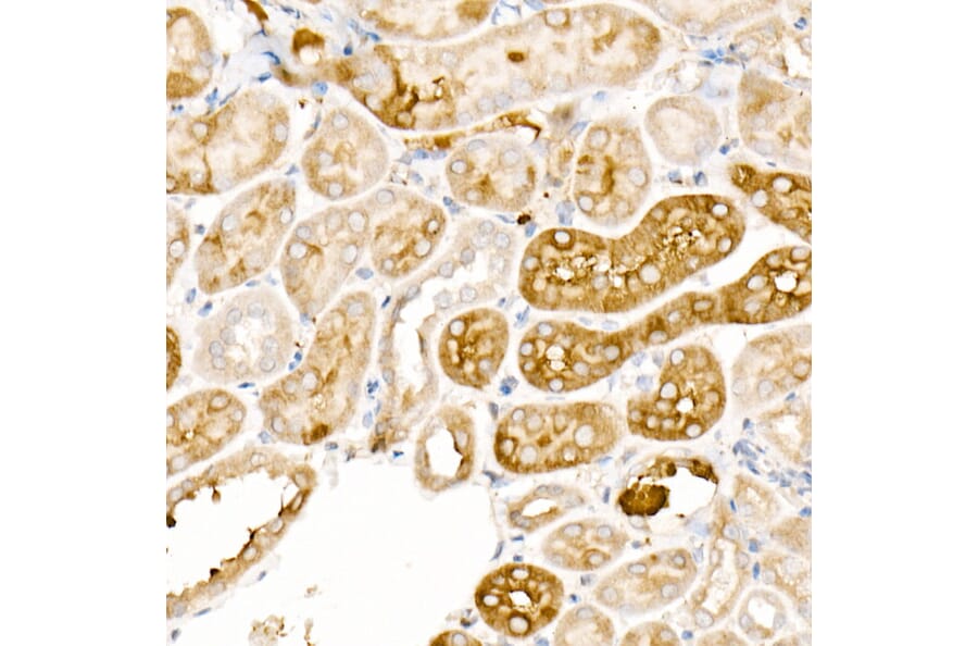 Immunohistochemistry - Anti-Ferritin Light Chain Antibody (A13644) - Antibodies.com