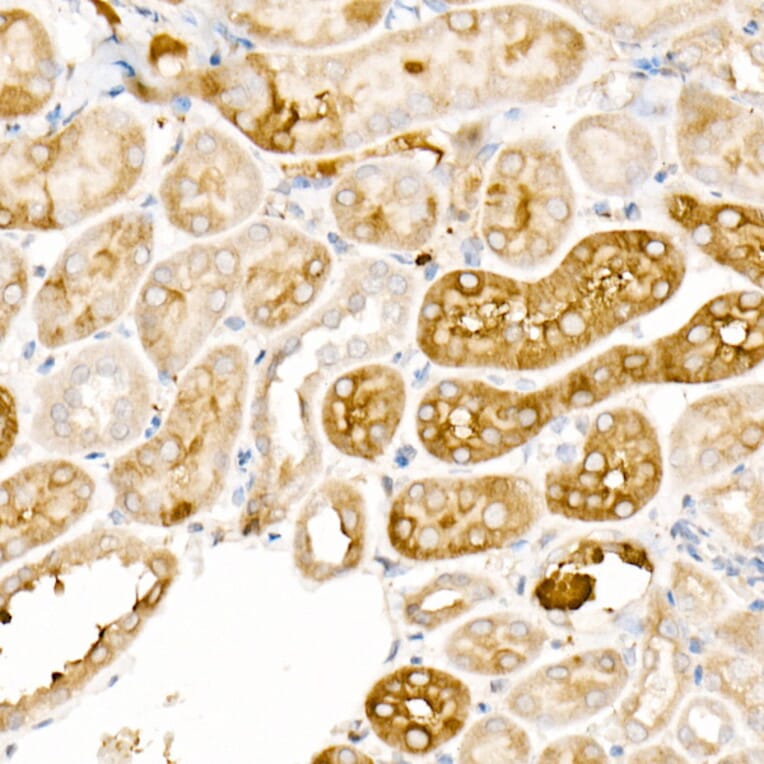 Immunohistochemistry - Anti-Ferritin Light Chain Antibody (A13644) - Antibodies.com