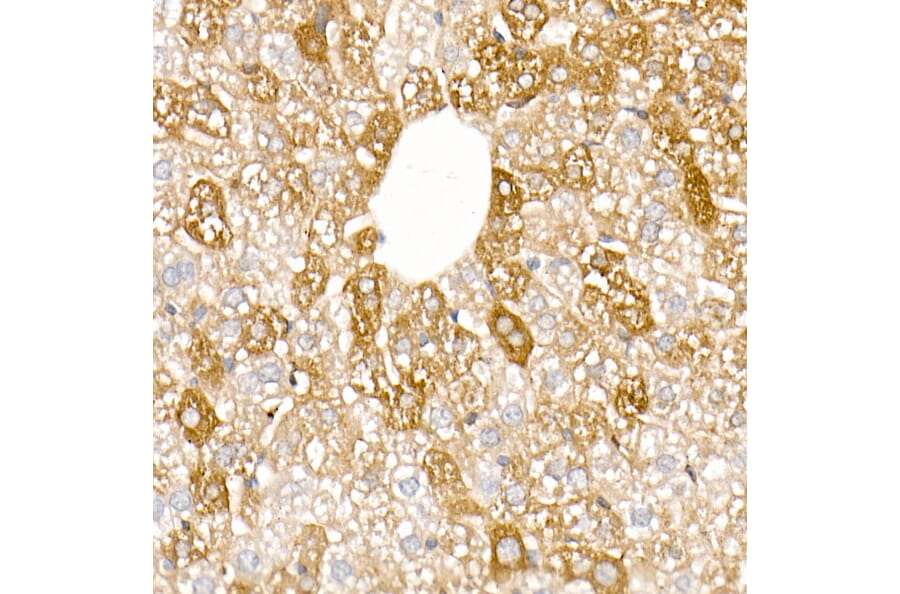 Immunohistochemistry - Anti-Ferritin Light Chain Antibody (A13644) - Antibodies.com