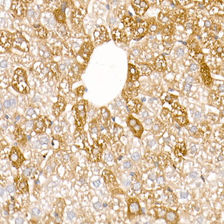 Immunohistochemistry - Anti-Ferritin Light Chain Antibody (A13644) - Antibodies.com