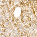 Immunohistochemistry - Anti-Ferritin Light Chain Antibody (A13644) - Antibodies.com