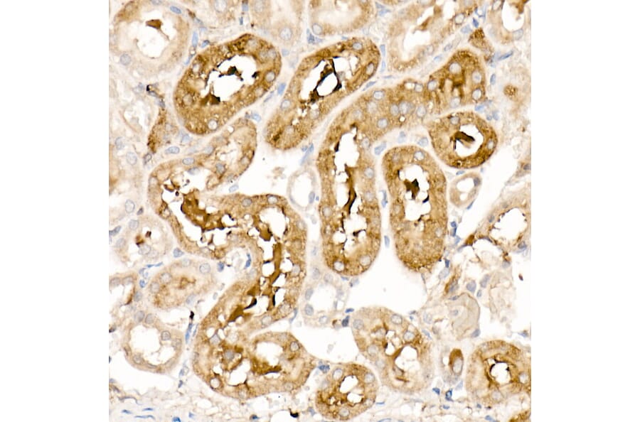 Immunohistochemistry - Anti-Ferritin Light Chain Antibody (A13644) - Antibodies.com