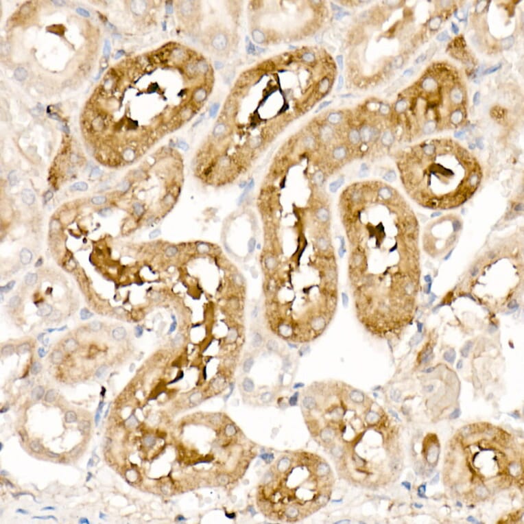 Immunohistochemistry - Anti-Ferritin Light Chain Antibody (A13644) - Antibodies.com