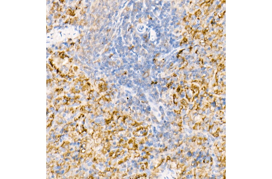 Immunohistochemistry - Anti-Ferritin Light Chain Antibody (A13644) - Antibodies.com