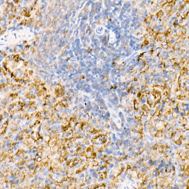 Immunohistochemistry - Anti-Ferritin Light Chain Antibody (A13644) - Antibodies.com