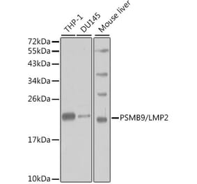 Western Blot - Anti-Proteasome 20S LMP2 Antibody (A13645) - Antibodies.com