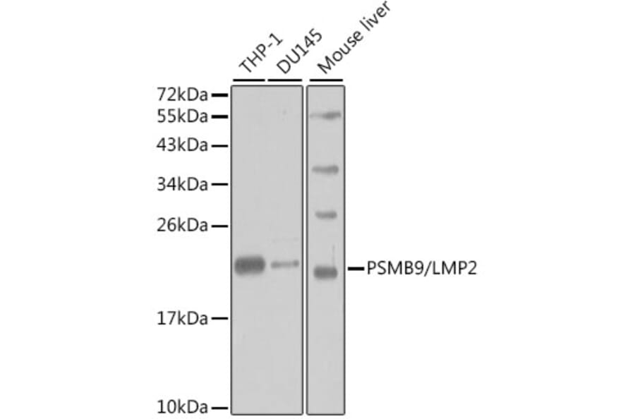 Western Blot - Anti-Proteasome 20S LMP2 Antibody (A13645) - Antibodies.com