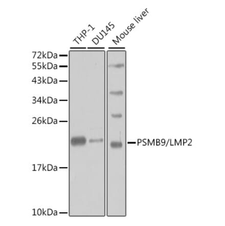 Western Blot - Anti-Proteasome 20S LMP2 Antibody (A13645) - Antibodies.com