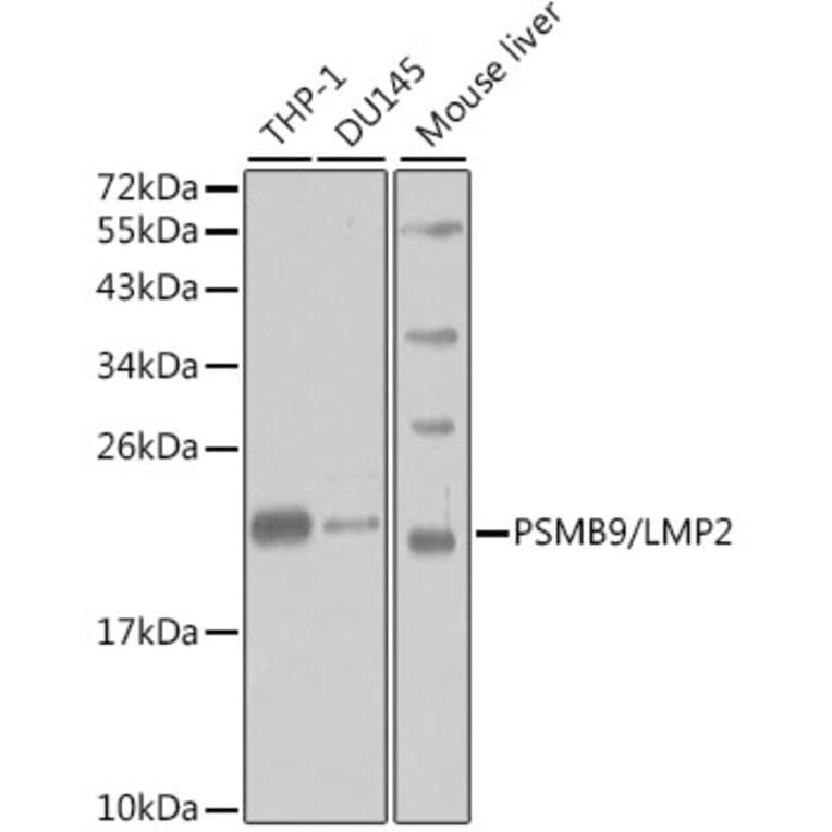 Western Blot - Anti-Proteasome 20S LMP2 Antibody (A13645) - Antibodies.com