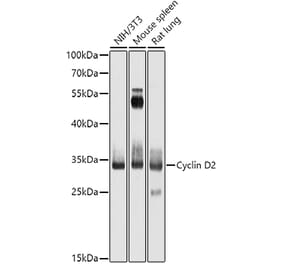 Western Blot - Anti-Cyclin D2 Antibody (A13646) - Antibodies.com
