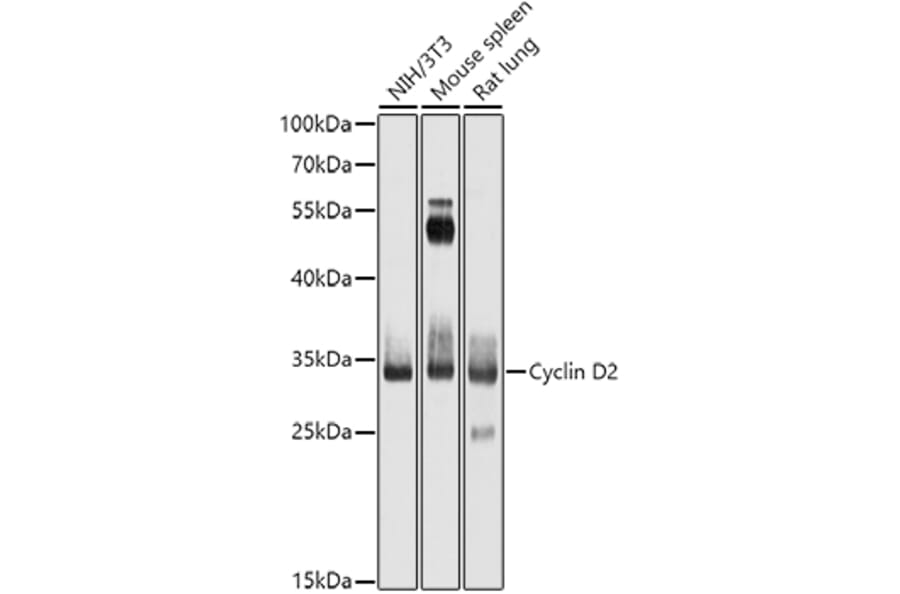Western Blot - Anti-Cyclin D2 Antibody (A13646) - Antibodies.com