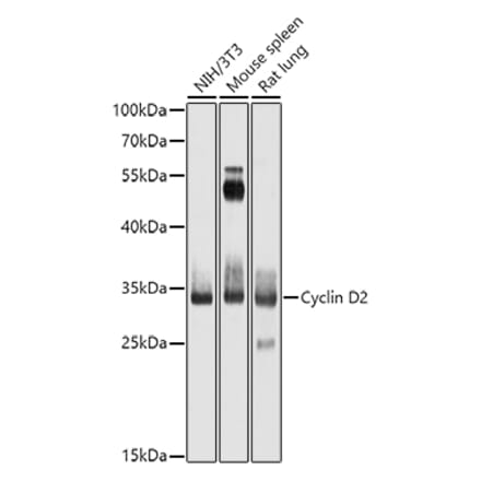 Western Blot - Anti-Cyclin D2 Antibody (A13646) - Antibodies.com