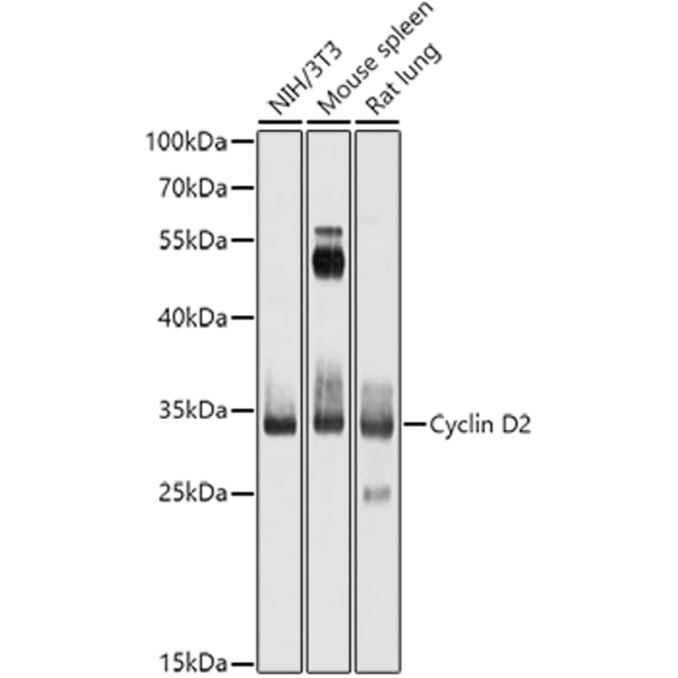Western Blot - Anti-Cyclin D2 Antibody (A13646) - Antibodies.com