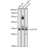 Western Blot - Anti-Cyclin D2 Antibody (A13646) - Antibodies.com