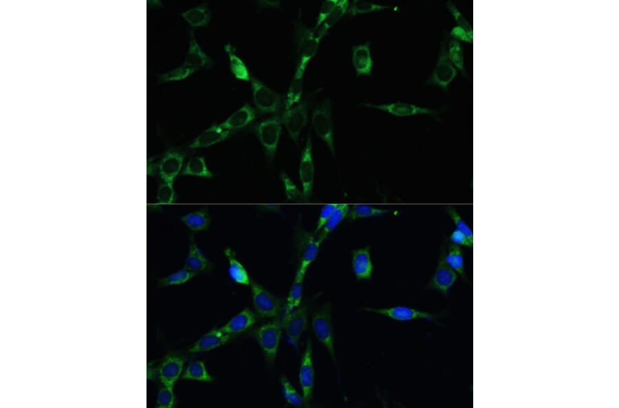 Immunofluorescence - Anti-BubR1 Antibody (A13647) - Antibodies.com