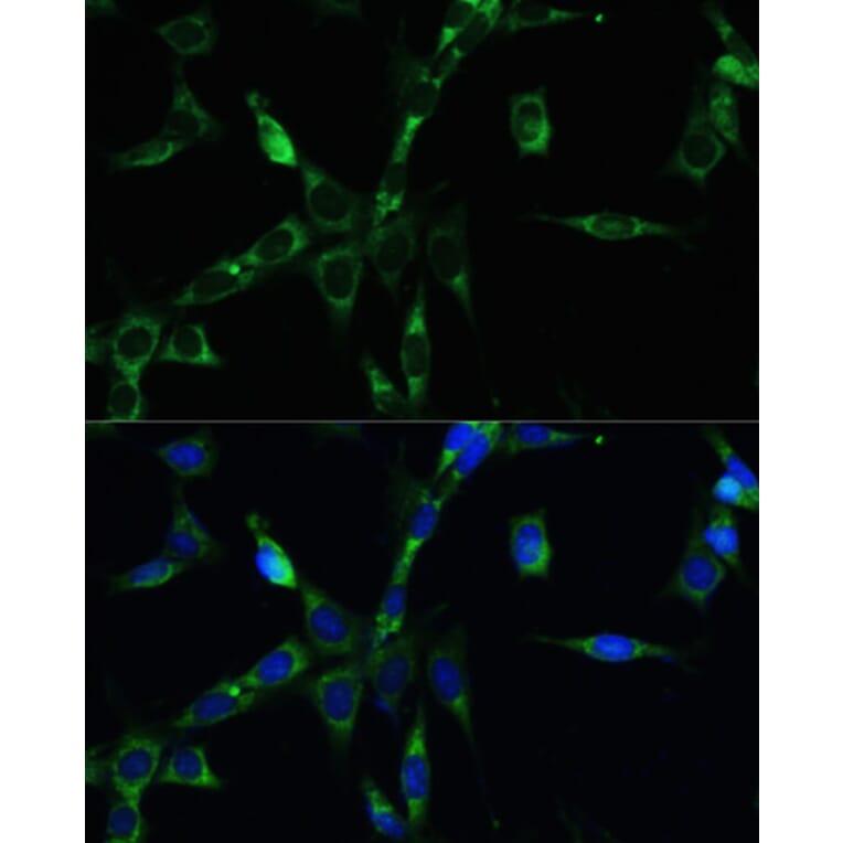 Immunofluorescence - Anti-BubR1 Antibody (A13647) - Antibodies.com