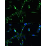 Immunofluorescence - Anti-BubR1 Antibody (A13647) - Antibodies.com