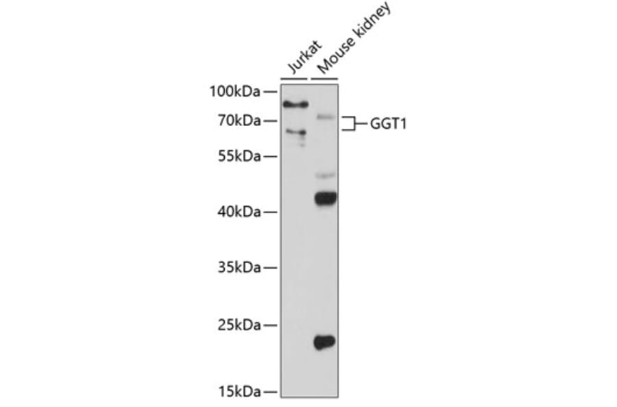Western Blot - Anti-GGT1/GGT Antibody (A13648) - Antibodies.com