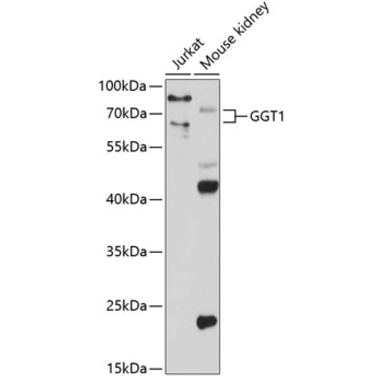 Western Blot - Anti-GGT1/GGT Antibody (A13648) - Antibodies.com