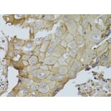 Immunohistochemistry - Anti-GGT1/GGT Antibody (A13648) - Antibodies.com