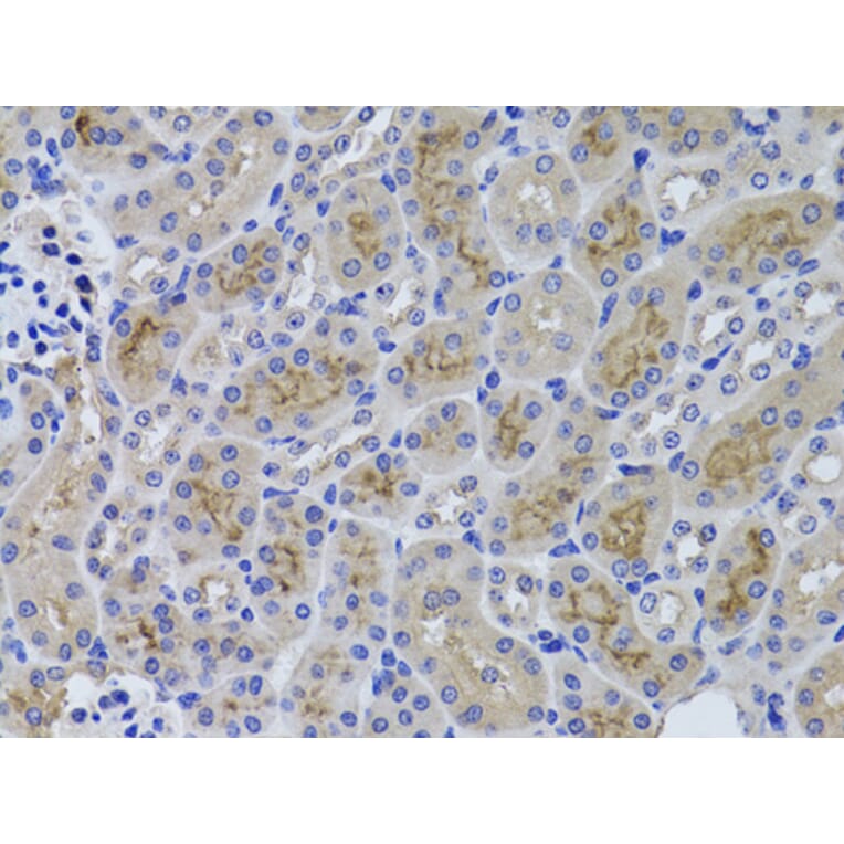 Immunohistochemistry - Anti-GGT1/GGT Antibody (A13648) - Antibodies.com