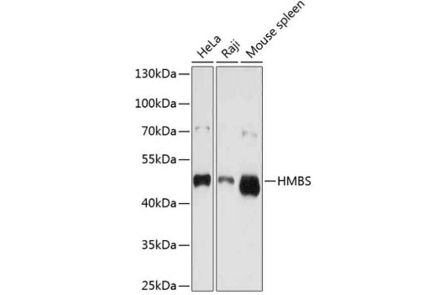 Western Blot - Anti-HMBS/PBGD Antibody (A13649) - Antibodies.com