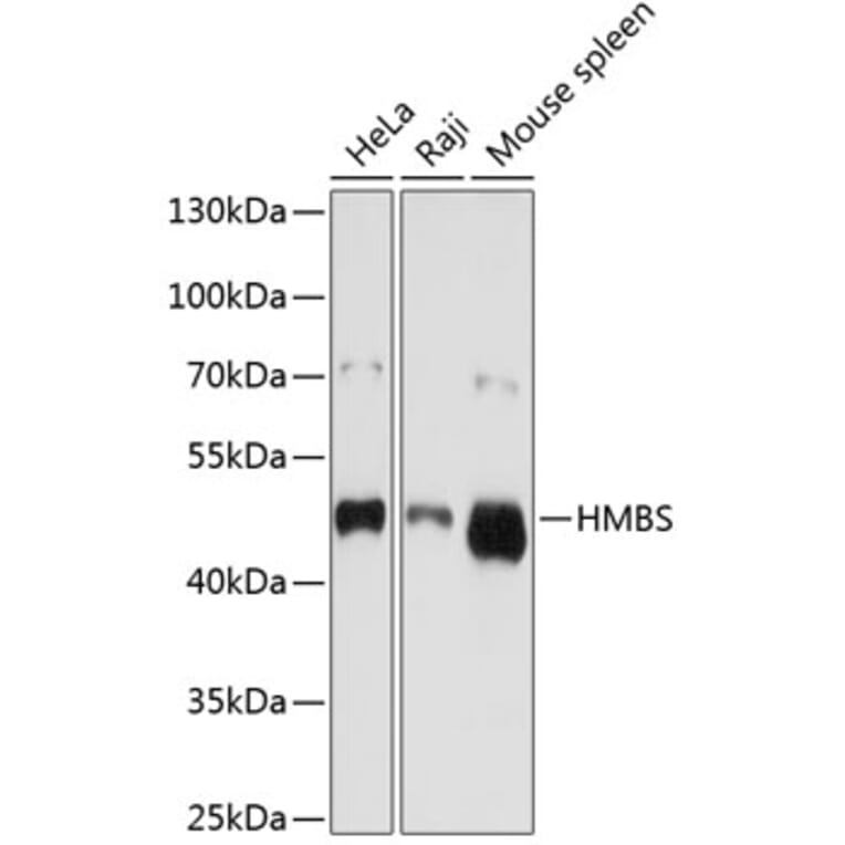 Western Blot - Anti-HMBS/PBGD Antibody (A13649) - Antibodies.com
