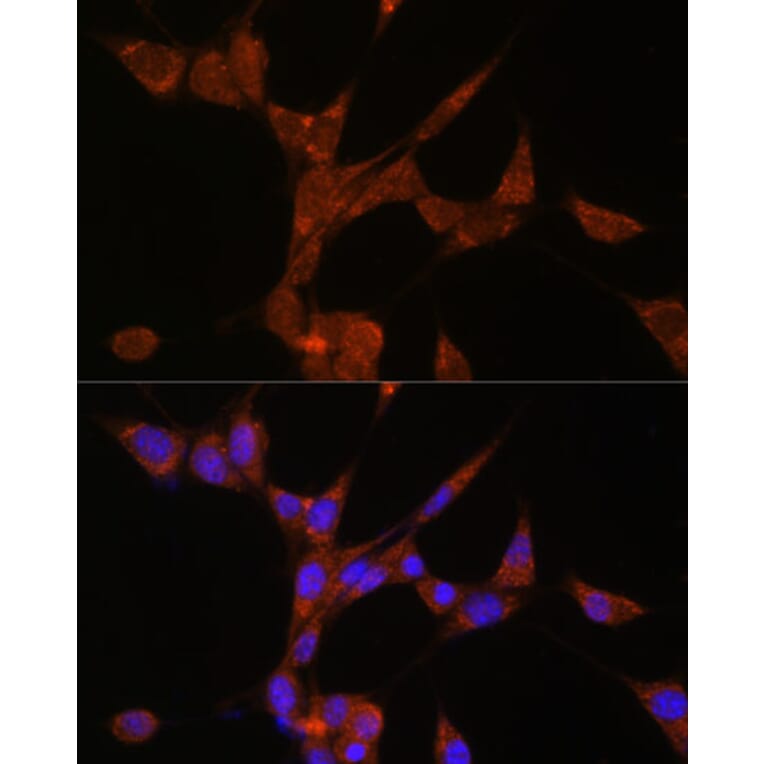 Immunofluorescence - Anti-AKR1C3 Antibody (A13650) - Antibodies.com