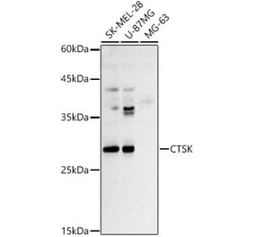 Western Blot - Anti-Cathepsin K Antibody (A13651) - Antibodies.com
